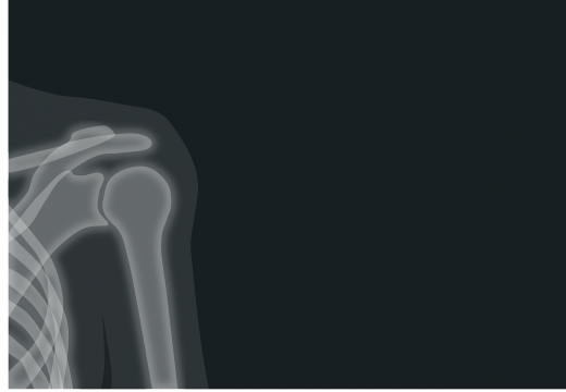 Que sont les rayons ionisants ?